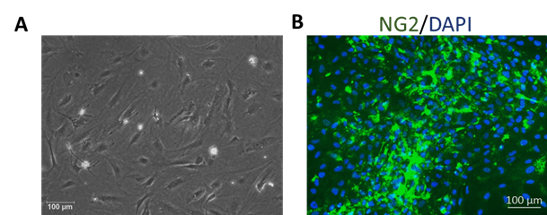 小鼠腦血管周細(xì)胞 (MBVP)