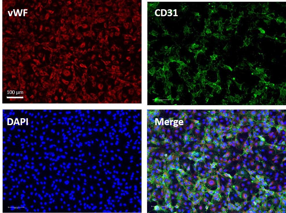 豬肺微血管內皮細胞