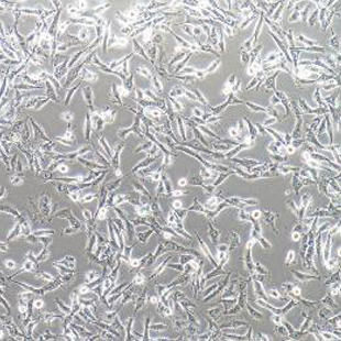 U251MG/TMZ 人類星形膠質(zhì)瘤耐替莫唑胺細胞