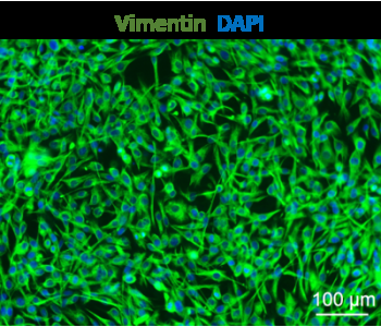 HSerC 人源賽爾托利細胞(睪丸營養(yǎng)細胞)