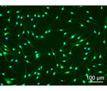 HEM-d 人源表皮黑色素細(xì)胞-Brown