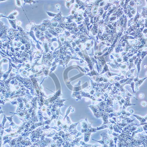 22Rv1 人前列腺癌細胞