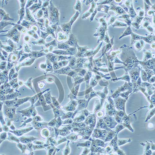 95-D 人高轉(zhuǎn)移肺癌細(xì)胞