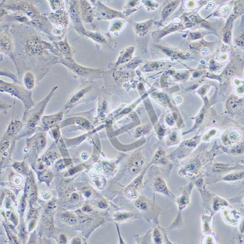 786-O 人腎透明細(xì)胞癌細(xì)胞