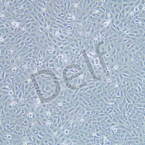 5637 人膀胱癌細(xì)胞