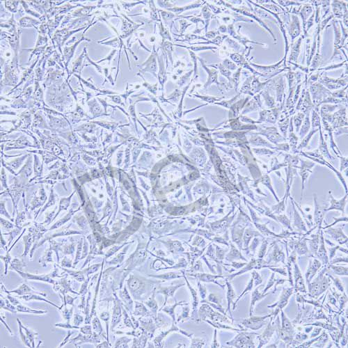 A172 人膠質(zhì)母細(xì)胞瘤細(xì)胞