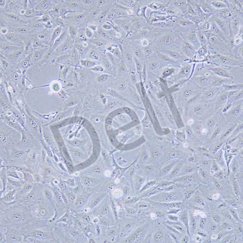 A875 人黑色素瘤細胞