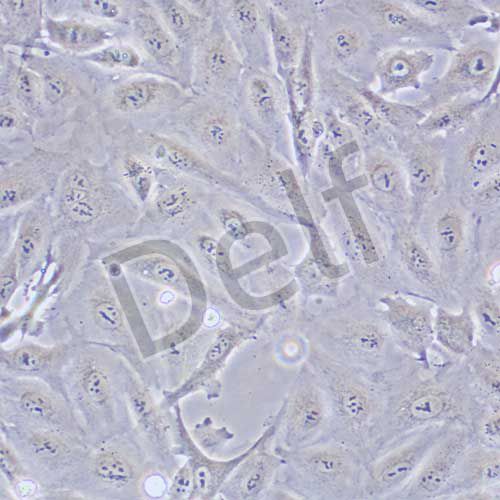 A875 人黑色素瘤細胞