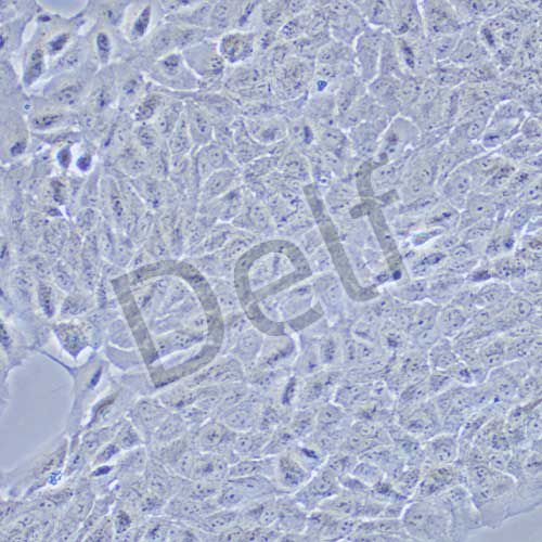 ARPE-19 人視網(wǎng)膜色素上皮細胞