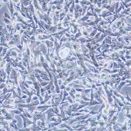B16 小鼠黑色素瘤細(xì)胞