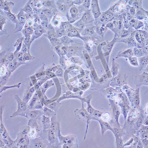 BCPAP 人甲狀腺癌細(xì)胞(乳頭狀)