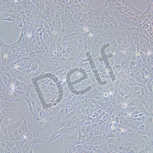 BEAS-2B 人支氣管上皮細胞