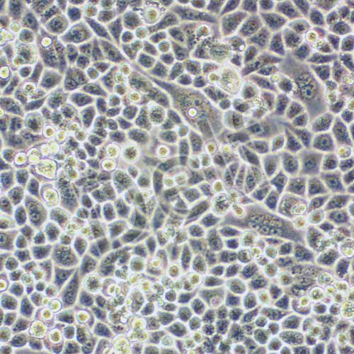 Bel-7402 人肝癌細(xì)胞