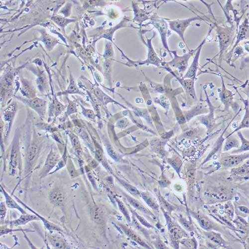 Bend.3 小鼠腦微血管內皮細胞株