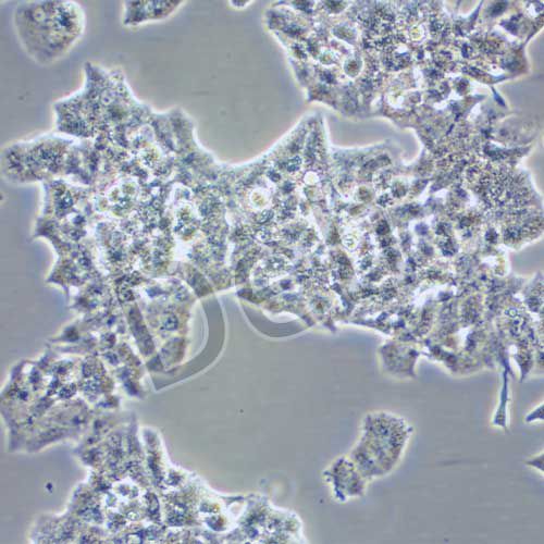 Beta-TC-6 小鼠胰島素瘤胰島β細(xì)胞