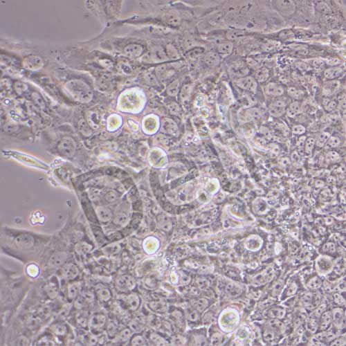 BeWo 人胎盤絨膜癌細胞
