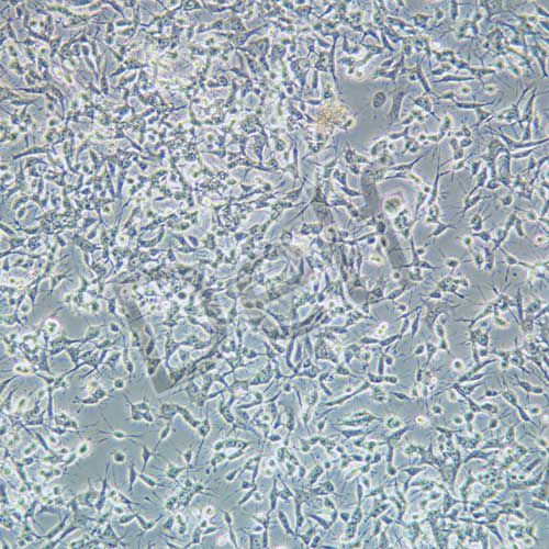 C666-1 人鼻咽癌細(xì)胞