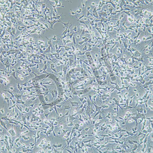 C666-1 人鼻咽癌細(xì)胞