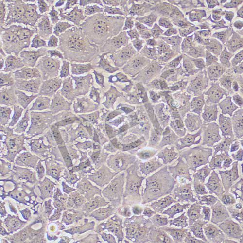 Caco-2 人結腸癌細胞
