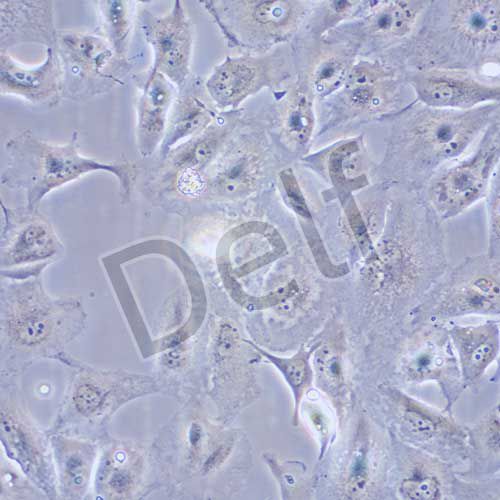 Caki-2 人腎透明細胞癌細胞