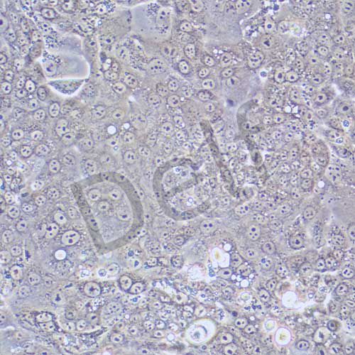 Capan-1 人胰腺癌細胞