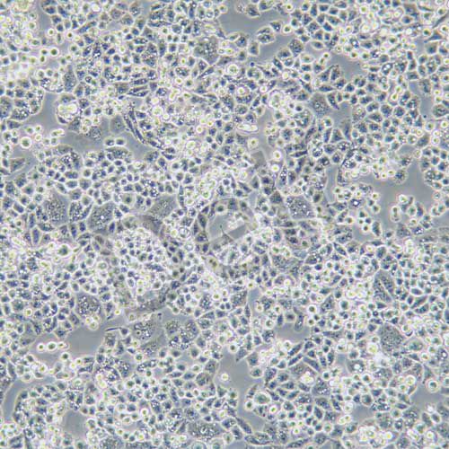 C-33A 人宮頸癌細(xì)胞