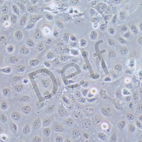 CASKI 人宮頸癌細(xì)胞