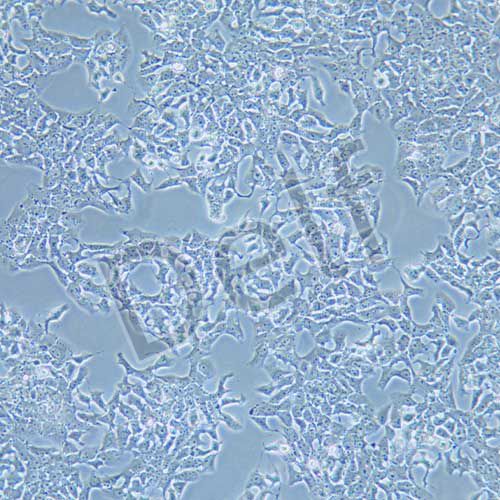 CBRH7919 大鼠肝癌細胞