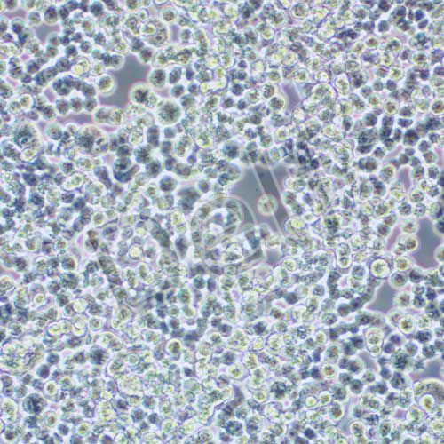 COLO320 人結(jié)直腸腺癌細(xì)胞