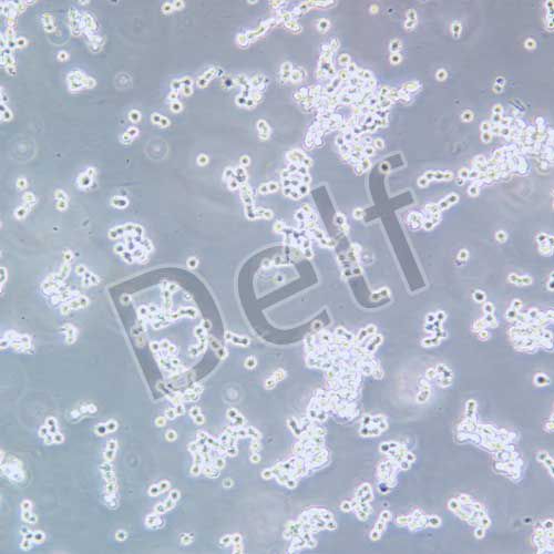 COLO320 HSR 人結(jié)直腸腺癌細(xì)胞