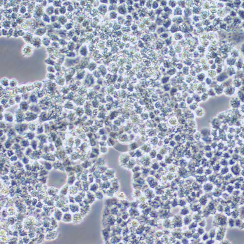 COV434 人卵巢顆粒腫瘤細(xì)胞