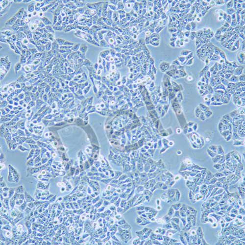 CX-1 人大腸癌細(xì)胞