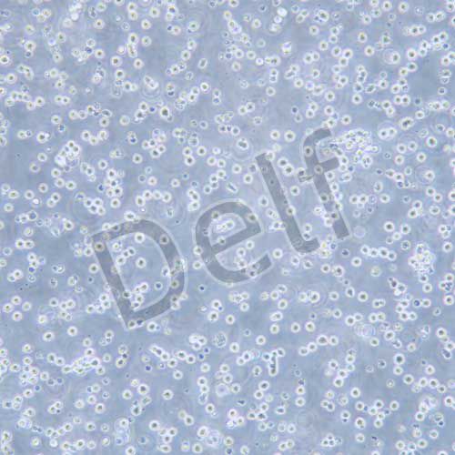 DAUDI 人Burkitt's淋巴瘤細(xì)胞