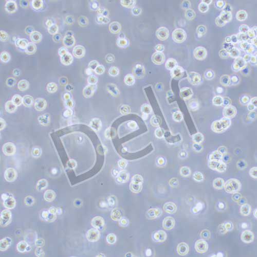 DAUDI 人Burkitt's淋巴瘤細(xì)胞