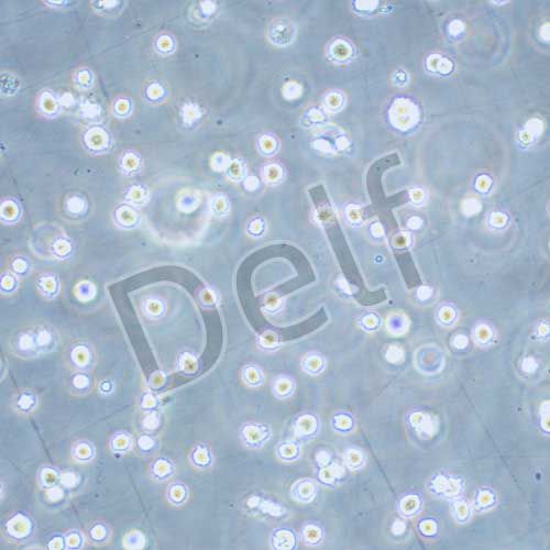 DB 人彌漫性大B細(xì)胞淋巴瘤細(xì)胞