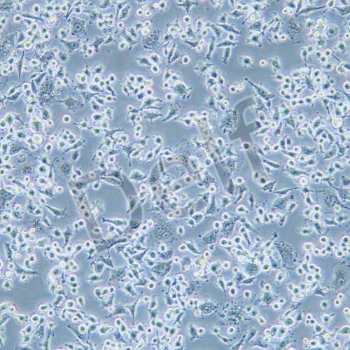DH82 狗腎惡性組織細胞增生癥細胞