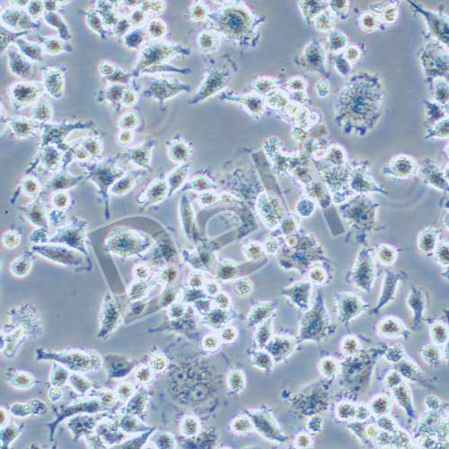 DH82 狗腎惡性組織細胞增生癥細胞