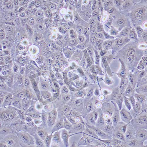 DU145 人前列腺癌細(xì)胞