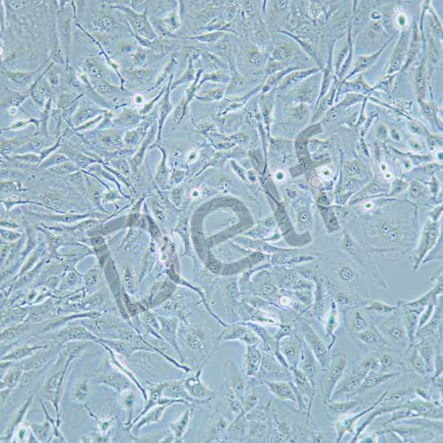 FTC-133 人甲狀腺癌細胞
