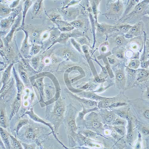 FTC-133 人甲狀腺癌細胞