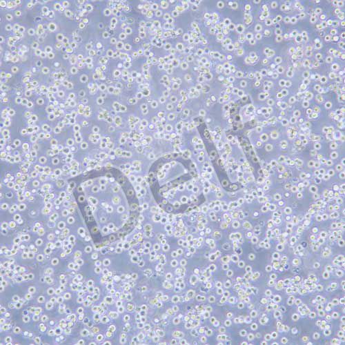 H22 小鼠肝癌細胞