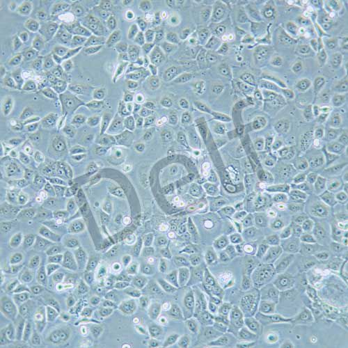 HCC-94 人子宮鱗癌細(xì)胞(高分化)