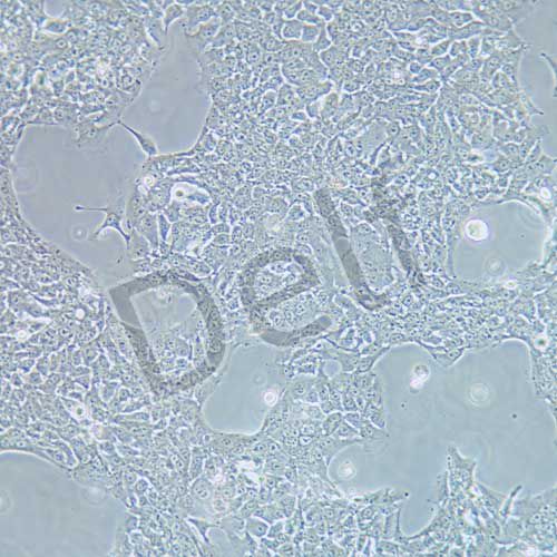 HCC827 人非小細(xì)胞肺癌細(xì)胞