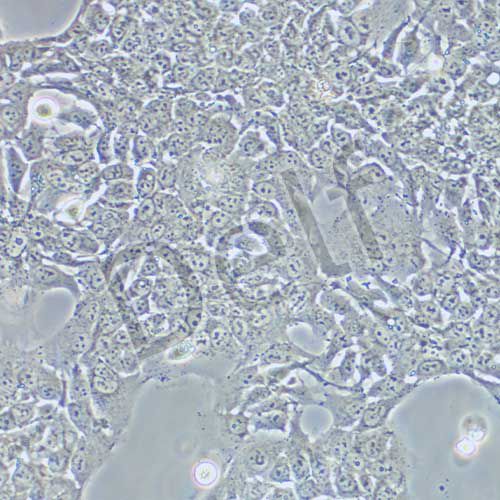 HCC827 人非小細(xì)胞肺癌細(xì)胞