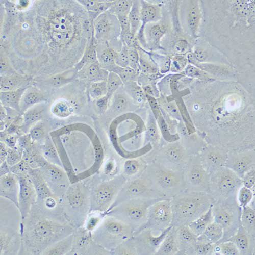 HCC1937 人乳腺癌細胞