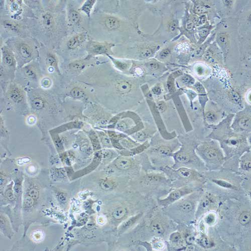 hccc-9810 人膽管細(xì)胞型肝癌細(xì)胞