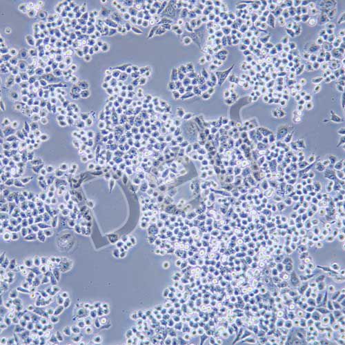 HCT-8 人回盲腸癌細胞