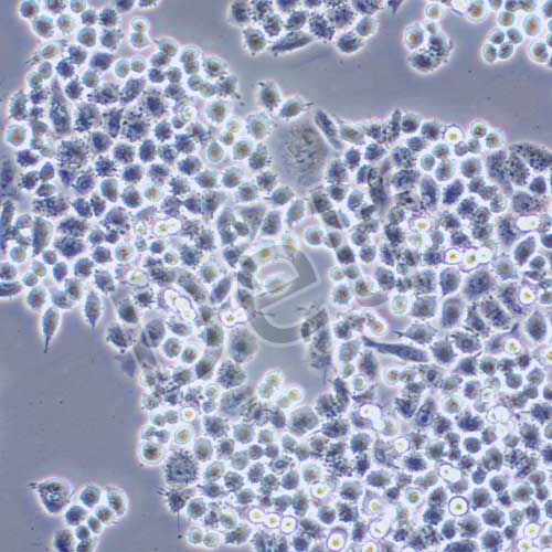 HCT-8 人回盲腸癌細胞