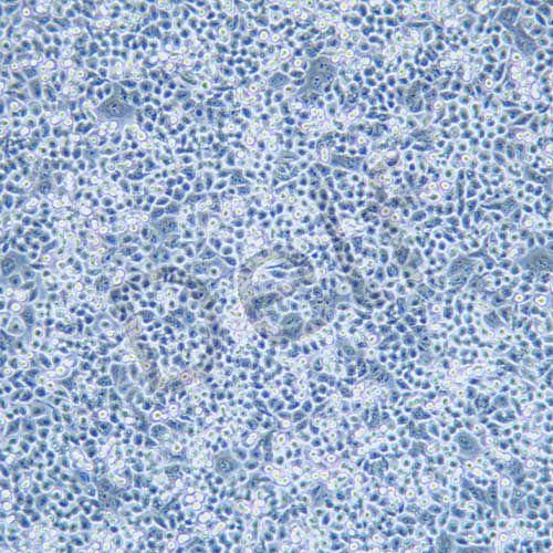HCT-15 人結(jié)腸癌細胞