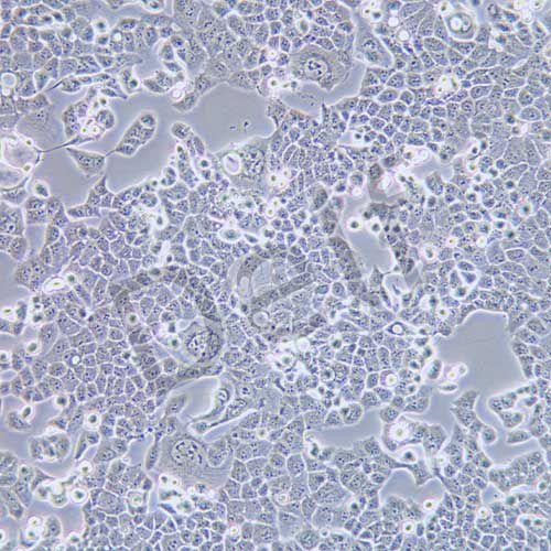 HEC-1-B 人子宮內(nèi)膜腺癌細胞